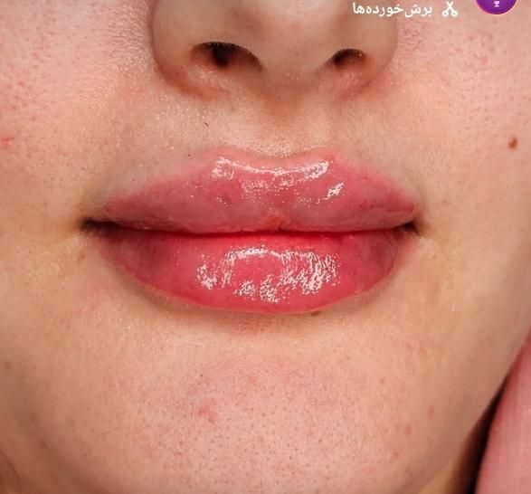 ۴۵۰،۰۰۰ ت هدیه باشگاه مشتریان یاناومایا (فیلر لب)|خدمات آرایشگری و زیبایی|دزفول, |دیوار