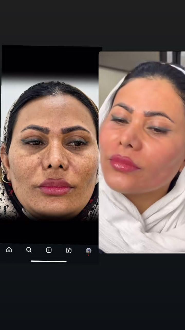 کرم لک سفید کننده فیلیپینی|آرایشی، بهداشتی، درمانی|بندرعباس, |دیوار