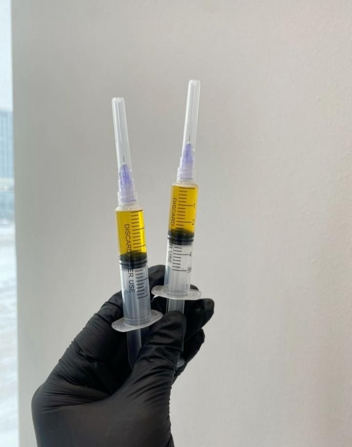 PRP/prpمو/prpصورت/درمان ریزش مو/درمان لک|خدمات آرایشگری و زیبایی|اصفهان, عباس‌آباد|دیوار