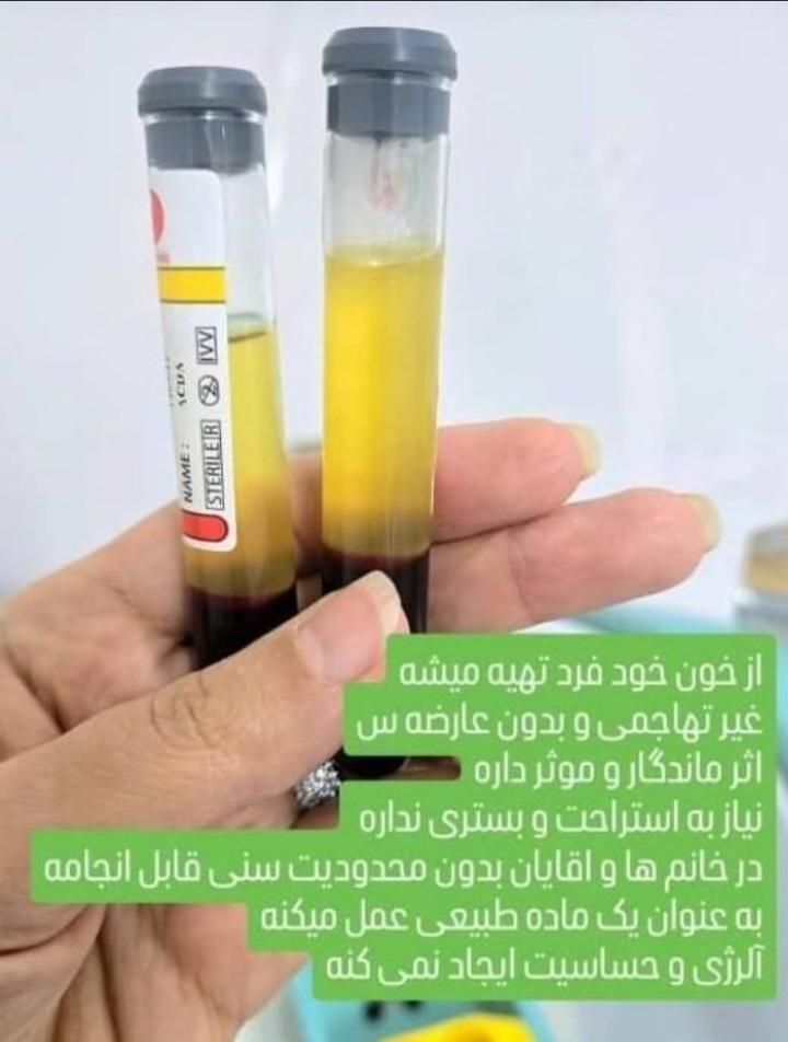 تزریق فیلر وبوتاکس مزو آنزیم پی ارپی آموزش کامل|خدمات آرایشگری و زیبایی|کرمانشاه, |دیوار