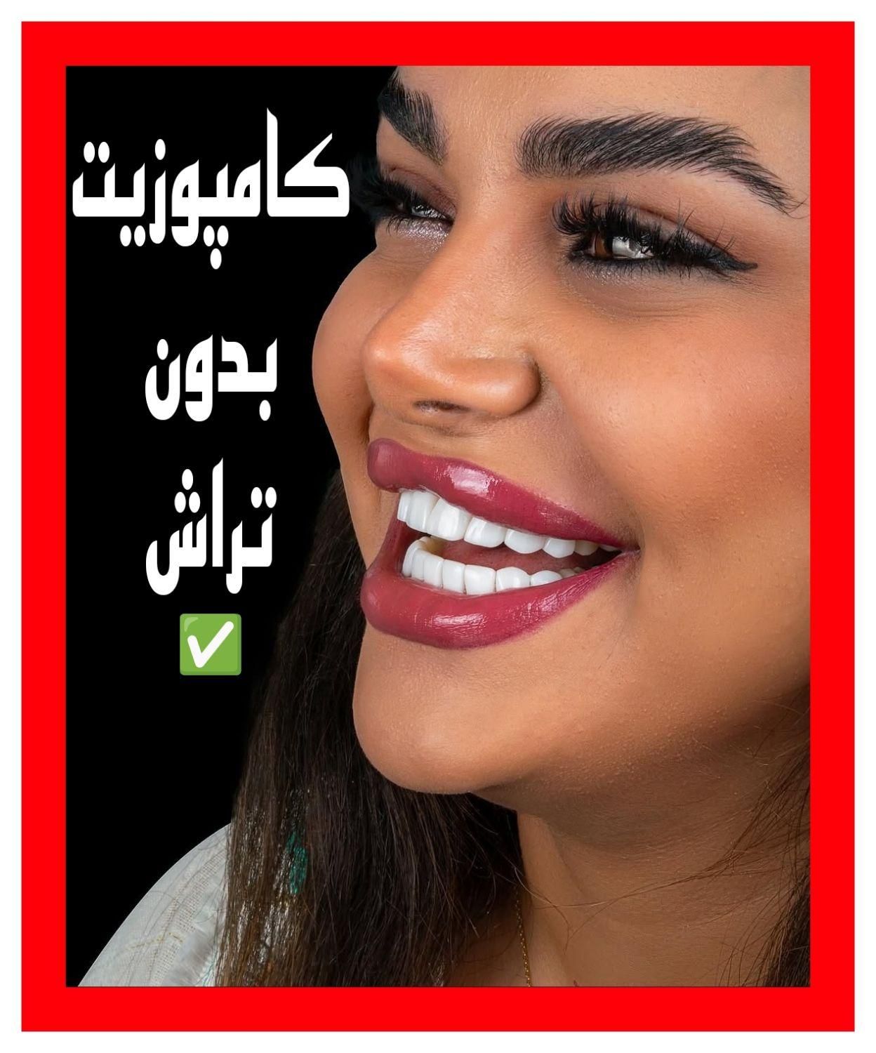 لمینیت کامپوزیت بریج و دندان مصنوعی و روکش|خدمات آرایشگری و زیبایی|تهران, آرژانتین|دیوار