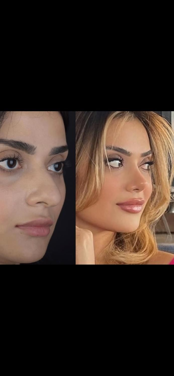 جراحی بینی پیکرتراشی برزیلی لیپو پروتز لیفت سینه|خدمات آرایشگری و زیبایی|تهران, تهرانپارس غربی|دیوار