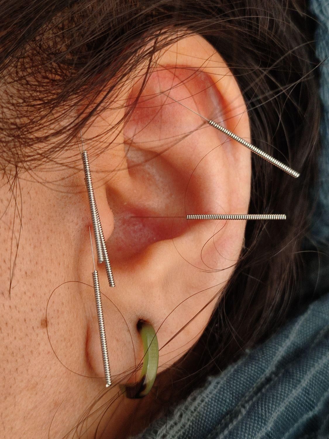 کلیه خدمات طب سنتی و طب سوزنی|خدمات آرایشگری و زیبایی|کرج, شاهین‌ویلا|دیوار