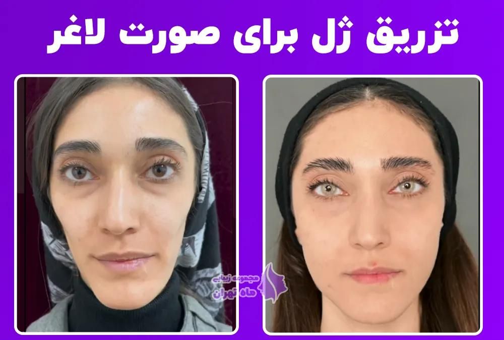 خدمات درمانی و زیبایی|خدمات آرایشگری و زیبایی|تهران, دروس|دیوار