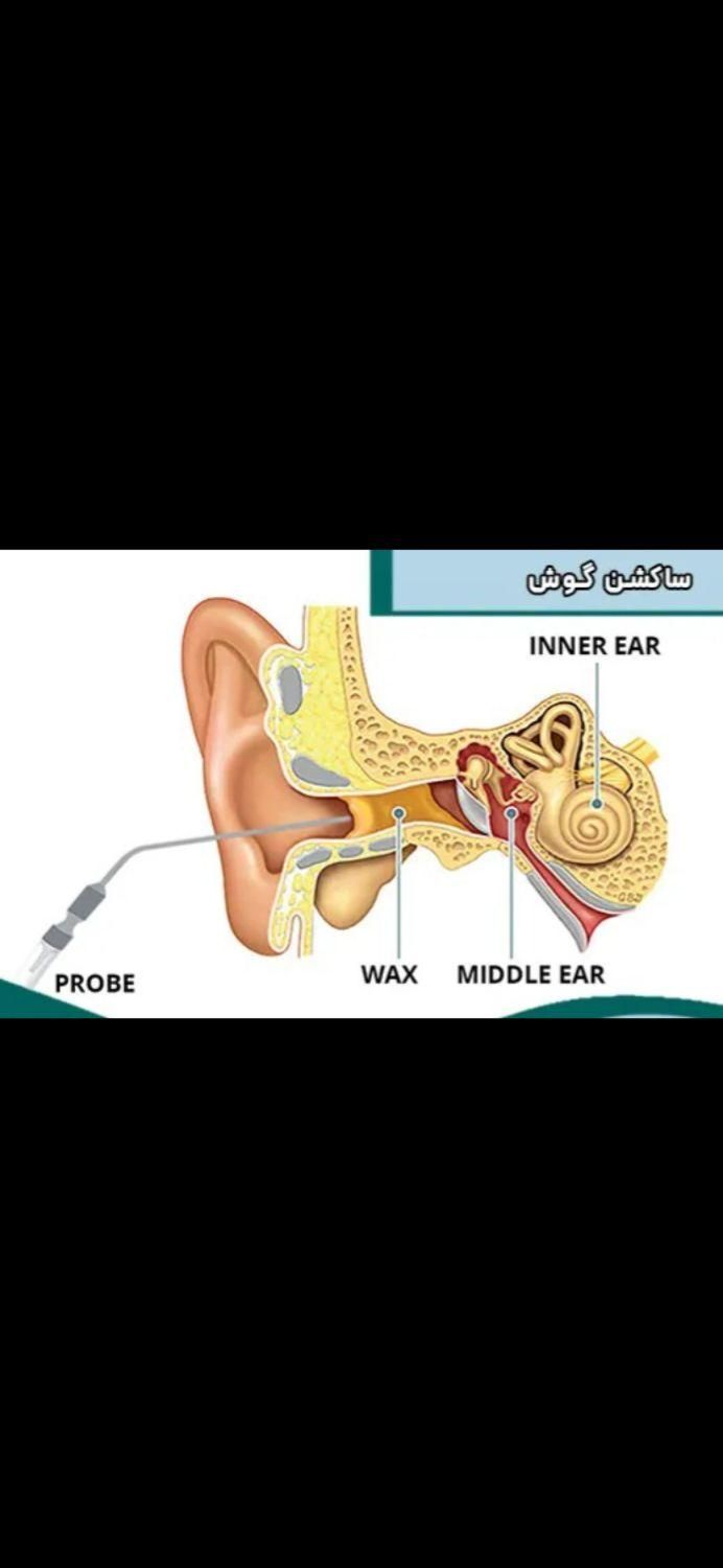 ساکشن گوش-شستشوی گوش|خدمات آرایشگری و زیبایی|دهدشت, |دیوار