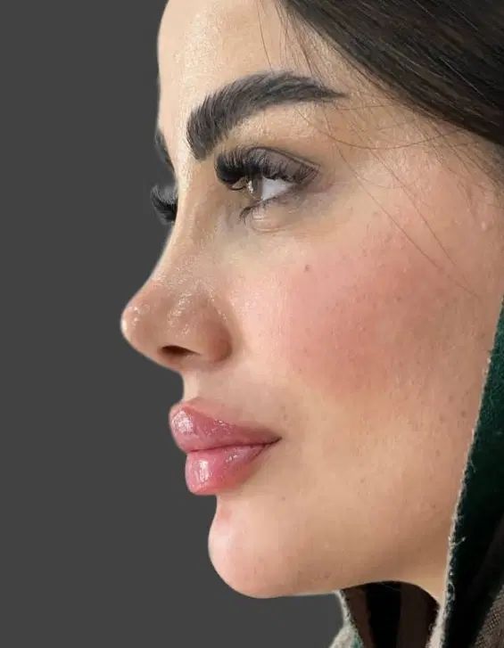 **تخفیف عمل بینی فقط تا آخر شهریور **لیپو و ابدو|خدمات آرایشگری و زیبایی|اسلام‌شهر, شهرک لاله|دیوار