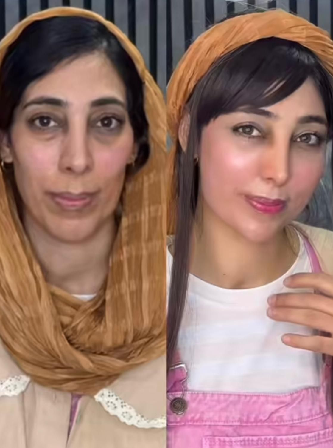 لیفت و جوانسازی صورت با ارزان ترین قیمت توسط پزشک|خدمات آرایشگری و زیبایی|مشهد, هنرستان|دیوار