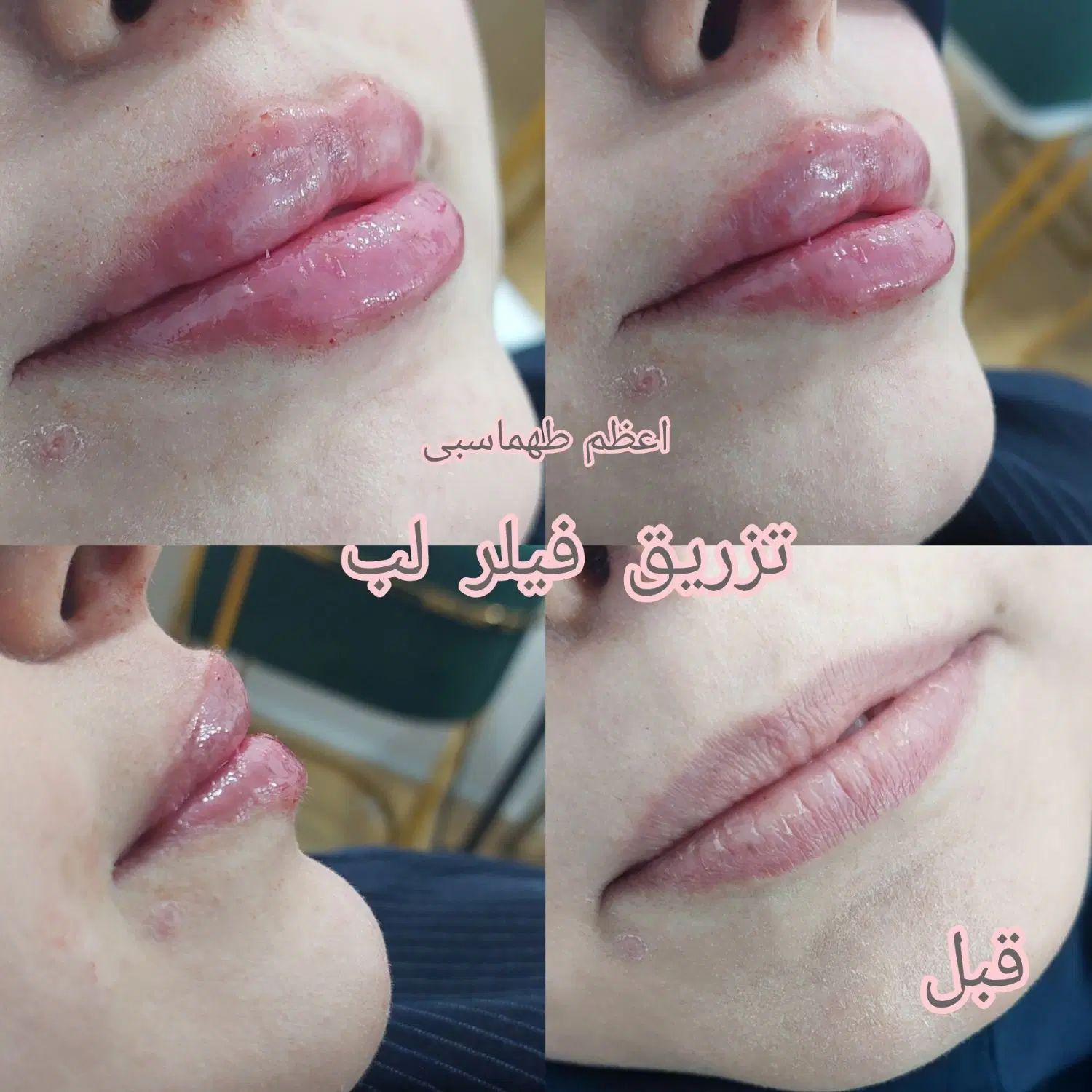خدمات تخصصی زیبایی پوست ومو (اعظم طهماسبی)|خدمات آرایشگری و زیبایی|ایذه, |دیوار