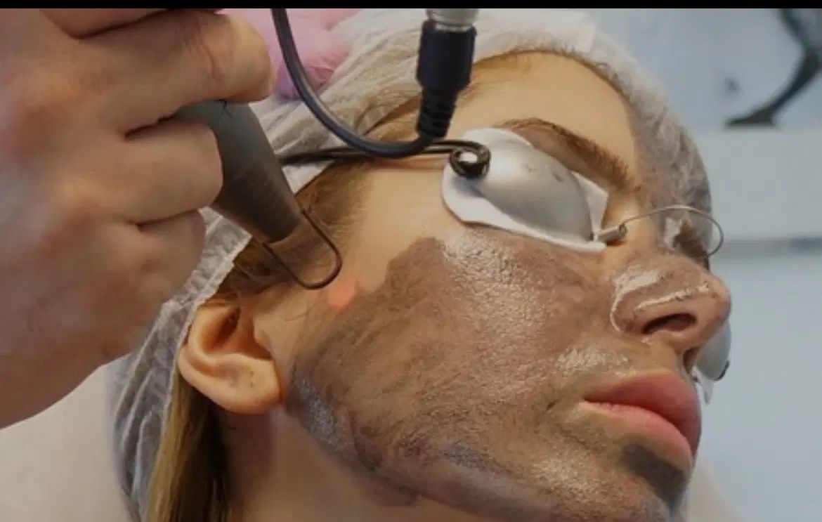 ریمو تتو ابرو،بدن کربن تراپی بادستگاه پیشرفته‌|خدمات آرایشگری و زیبایی|اهواز, کیانپارس |دیوار