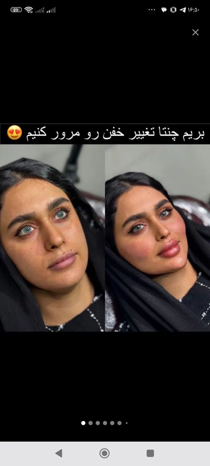 فیلر ژل بوتاکس مزو لیزر هایفو فول فیس ۵۰٪ آف|خدمات آرایشگری و زیبایی|مشهد, فرهنگ|دیوار