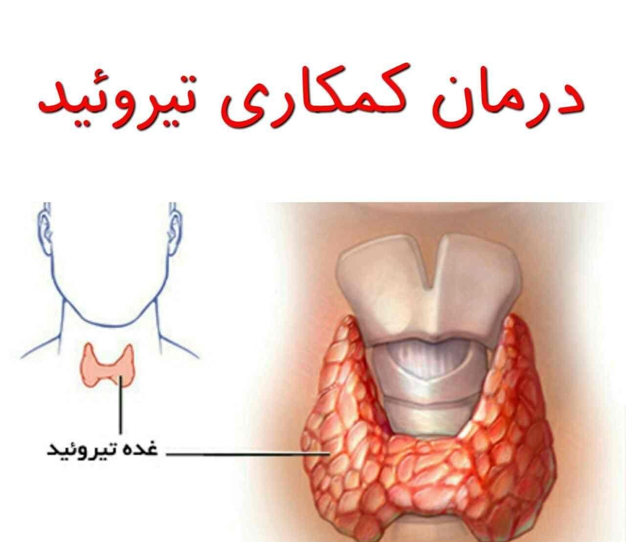 ایا هنوزم برای درمان تیرویید لوتیروکسین مصرف میکنی|خوردنی و آشامیدنی|تهران, آشتیانی|دیوار