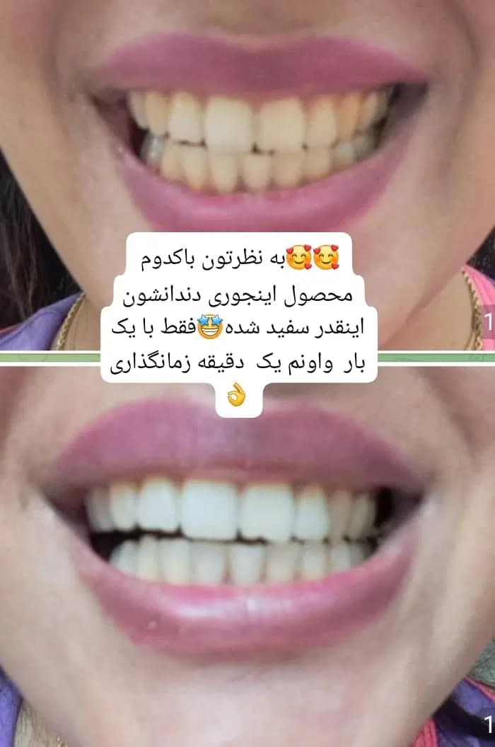 اسپری سفید کننده دندان وخوشبوکننده دهان|آرایشی، بهداشتی، درمانی|زاهدان, |دیوار