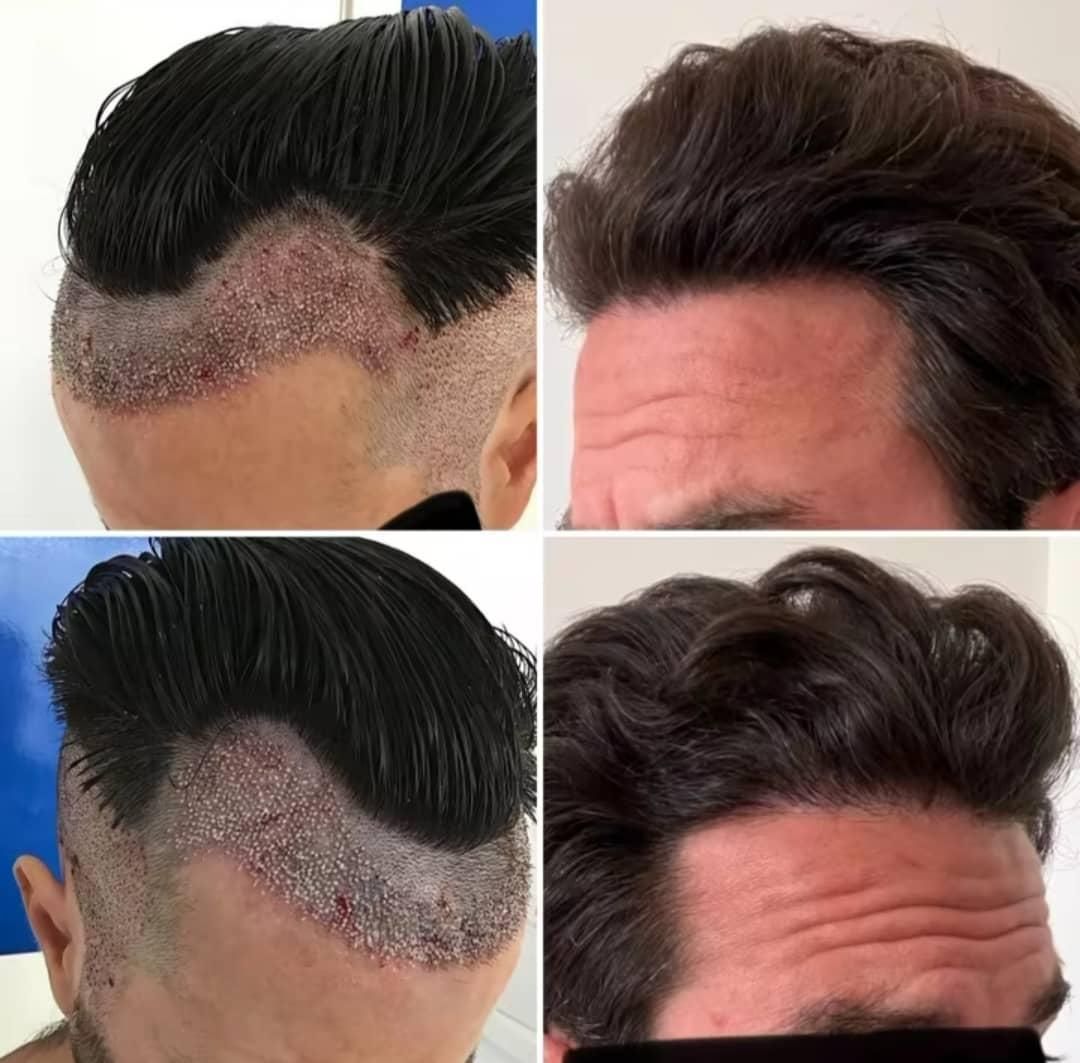 جشنوارهکاشت مو و ابرو و ریش وسبیل|خدمات آرایشگری و زیبایی|اهواز, اسماعیلیه|دیوار