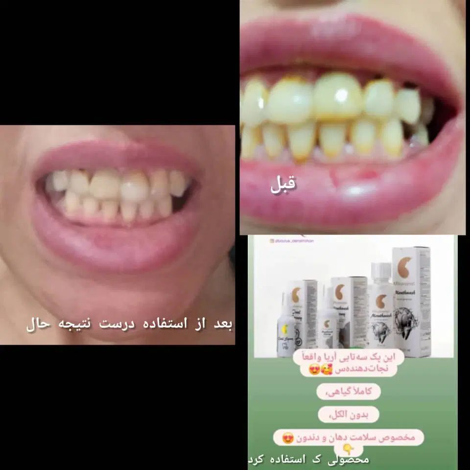 اسپری سفید کننده دندان وخوشبوکننده دهان|آرایشی، بهداشتی، درمانی|زاهدان, |دیوار