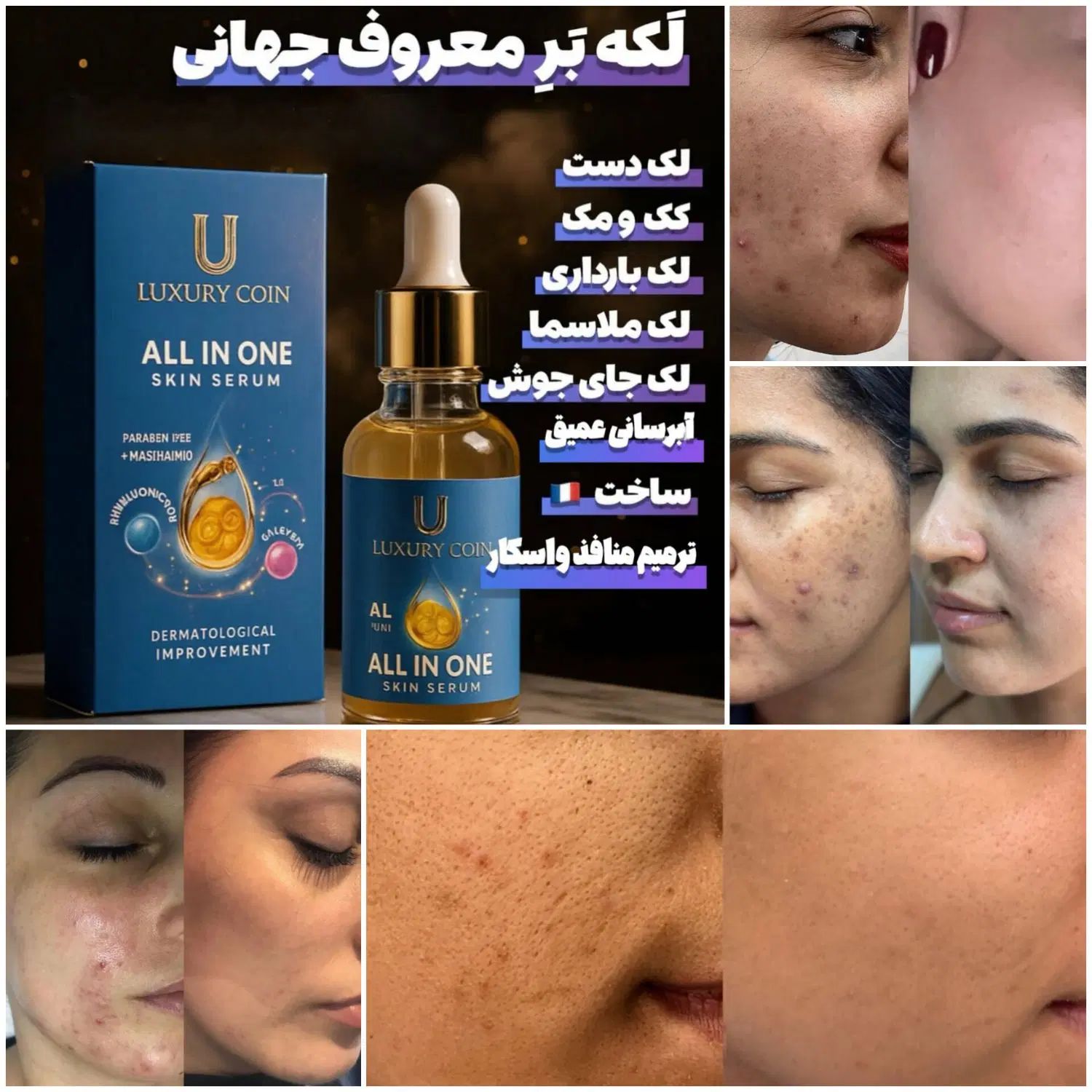 رف انواع لک و کک ومک (لکه بر معروف جهانی فرانسوی)|آرایشی، بهداشتی، درمانی|تهران, زعفرانیه|دیوار