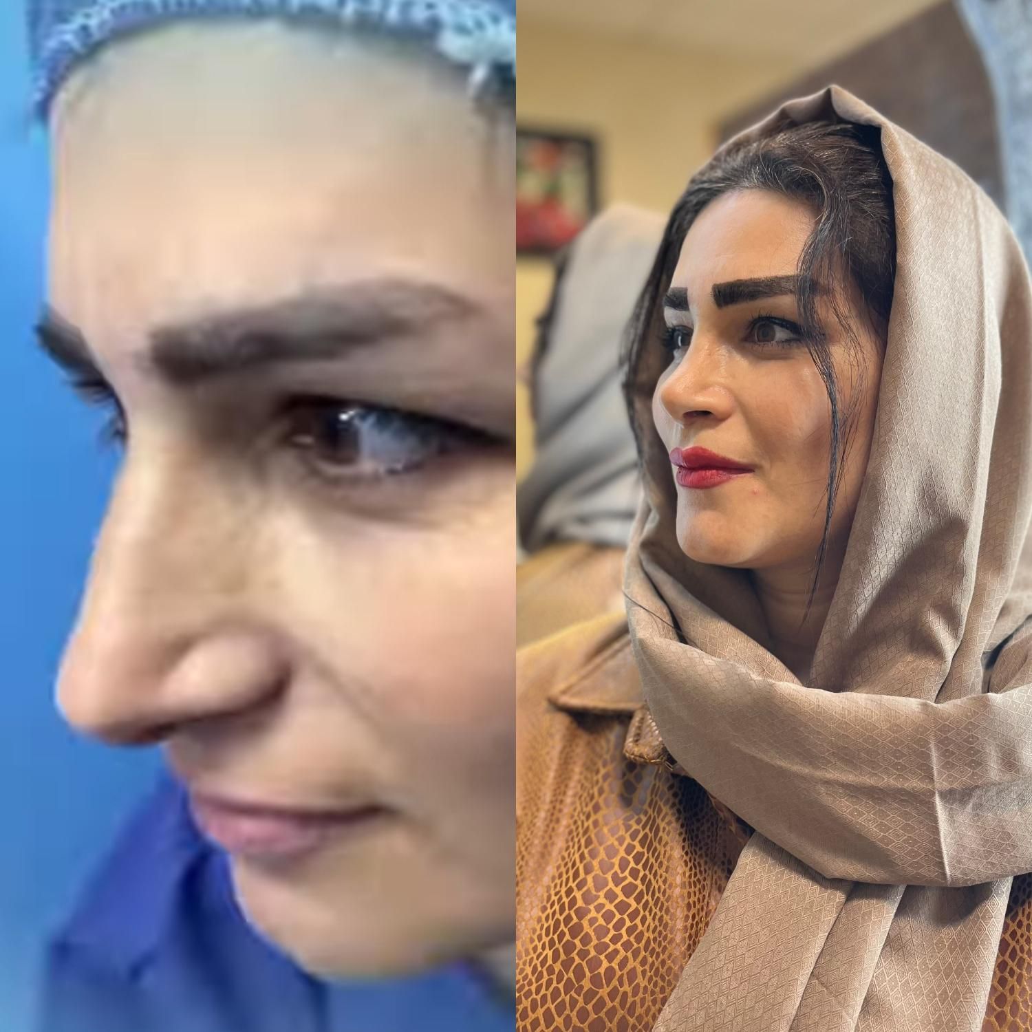 جشنواره عمل بینی فقط با ۲۵ میلیون|خدمات آرایشگری و زیبایی|رشت, رشتیان|دیوار