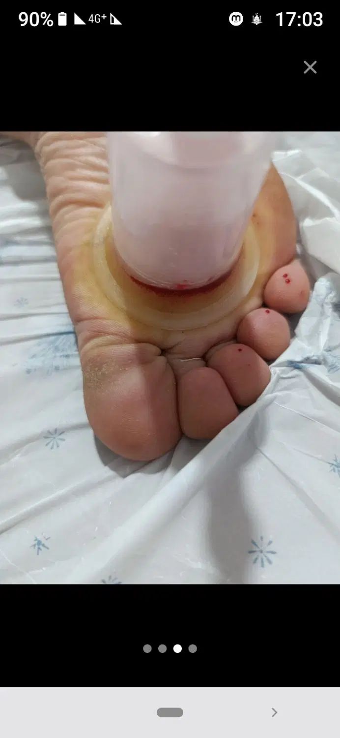 ماساژ ورگ گیری ،حجامت، دیسک ، ،زالو|خدمات آرایشگری و زیبایی|نیشابور, شهرک جانبازان|دیوار