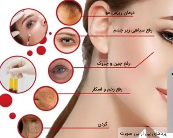 جلسه اول لیزر موهای زائد با کربن تراپی رایگان|خدمات آرایشگری و زیبایی|نجف‌آباد, شریعتی|دیوار