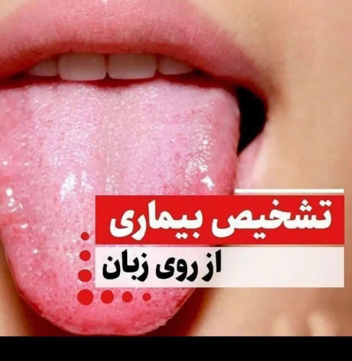 تشخیص بیماری از روی زبان|فعالیت داوطلبانه|کرج, گوهردشت|دیوار