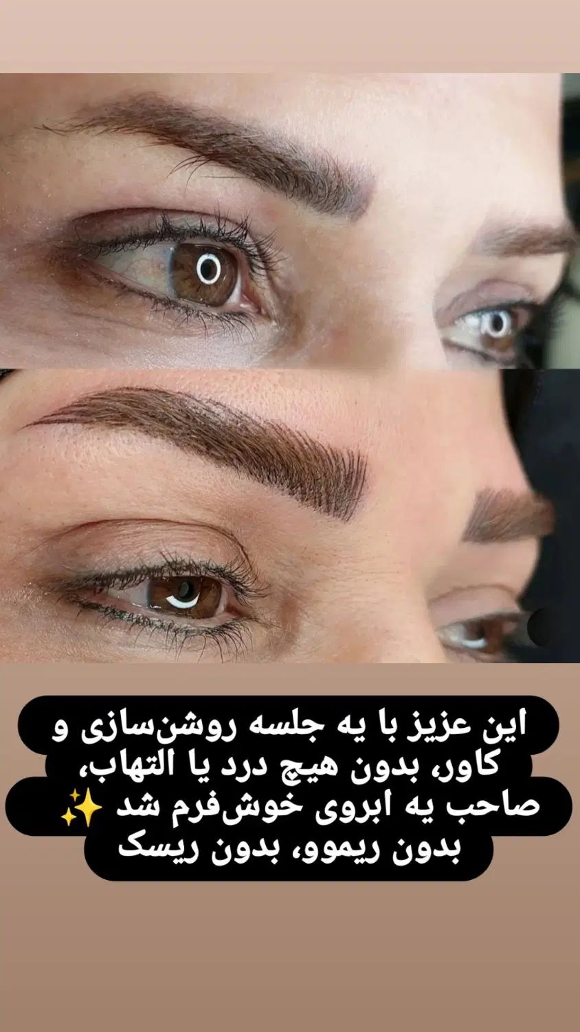 میکروبلیدینگ وروشن سازی تتو تیره بدون نیازبه ریموو|خدمات آرایشگری و زیبایی|بندرعباس, |دیوار