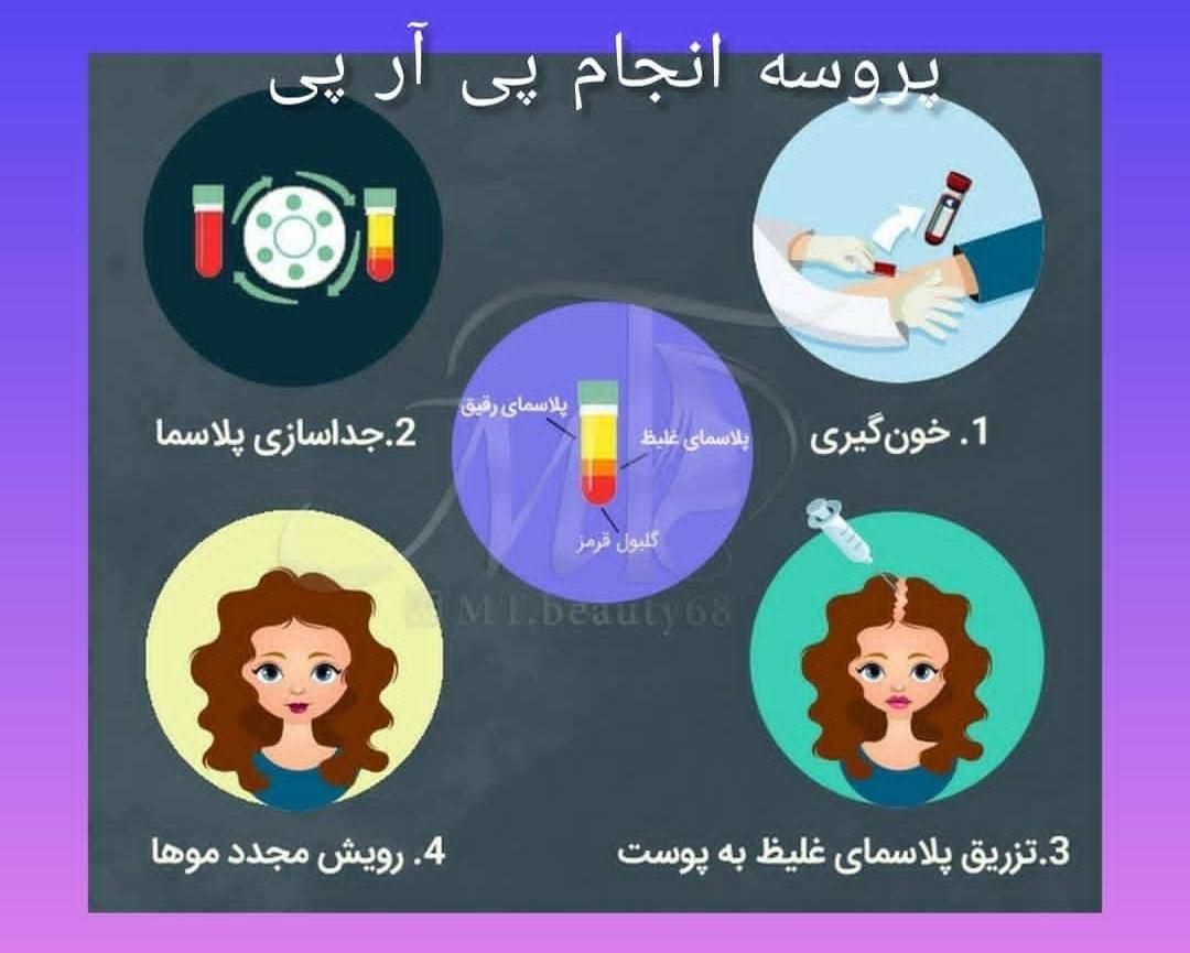 معجزه جوانسازی با پی آر پی در مطب|خدمات آرایشگری و زیبایی|قم, امام|دیوار