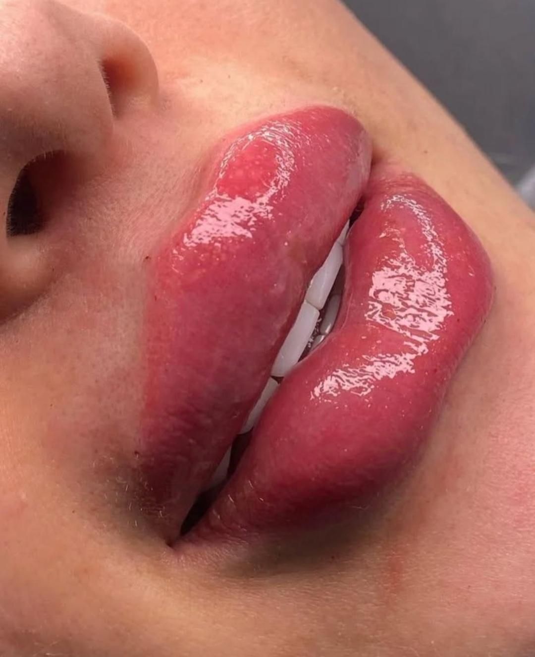 جشنواره ویژه ژل و بوتاکس|خدمات آرایشگری و زیبایی|اردبیل, |دیوار