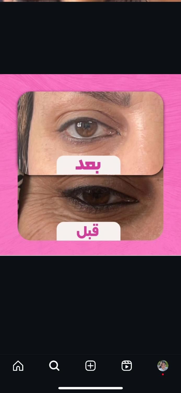کلینیک زیبایی سلین|خدمات آرایشگری و زیبایی|تهران, خواجه نصیر طوسی|دیوار