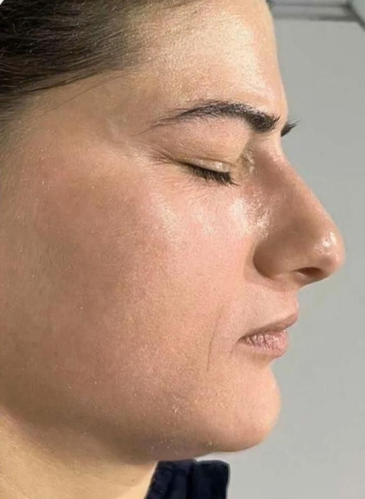 خدمات حرفه ای تخصصی،لک کک مک موی زائدسفیدالکترولیز|خدمات آرایشگری و زیبایی|قم, صفائیه|دیوار