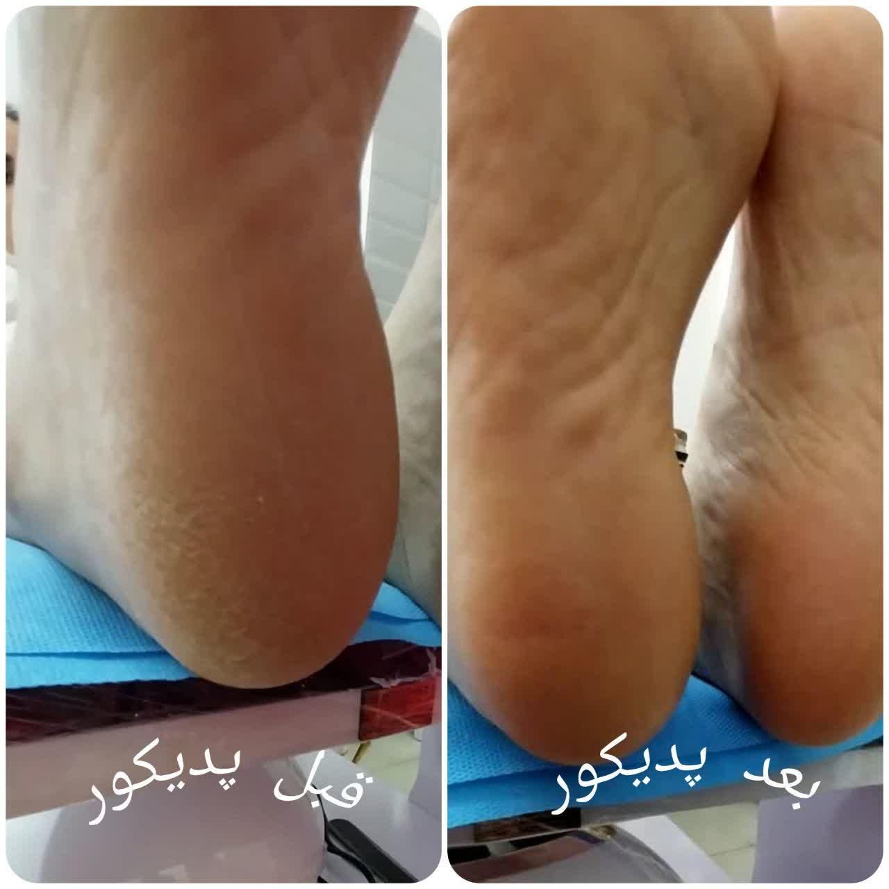 پدیکور تخصصی  و فشیال فردیس|خدمات آرایشگری و زیبایی|فردیس, فردیس|دیوار