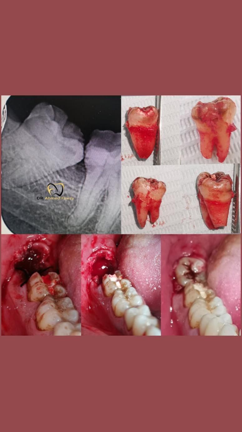 کشیدن با تعرفه خیریه|خدمات آرایشگری و زیبایی|قم, زنبیل آباد|دیوار