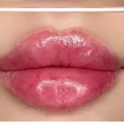ژل و بوتاکس|خدمات آرایشگری و زیبایی|فولادشهر, C4|دیوار