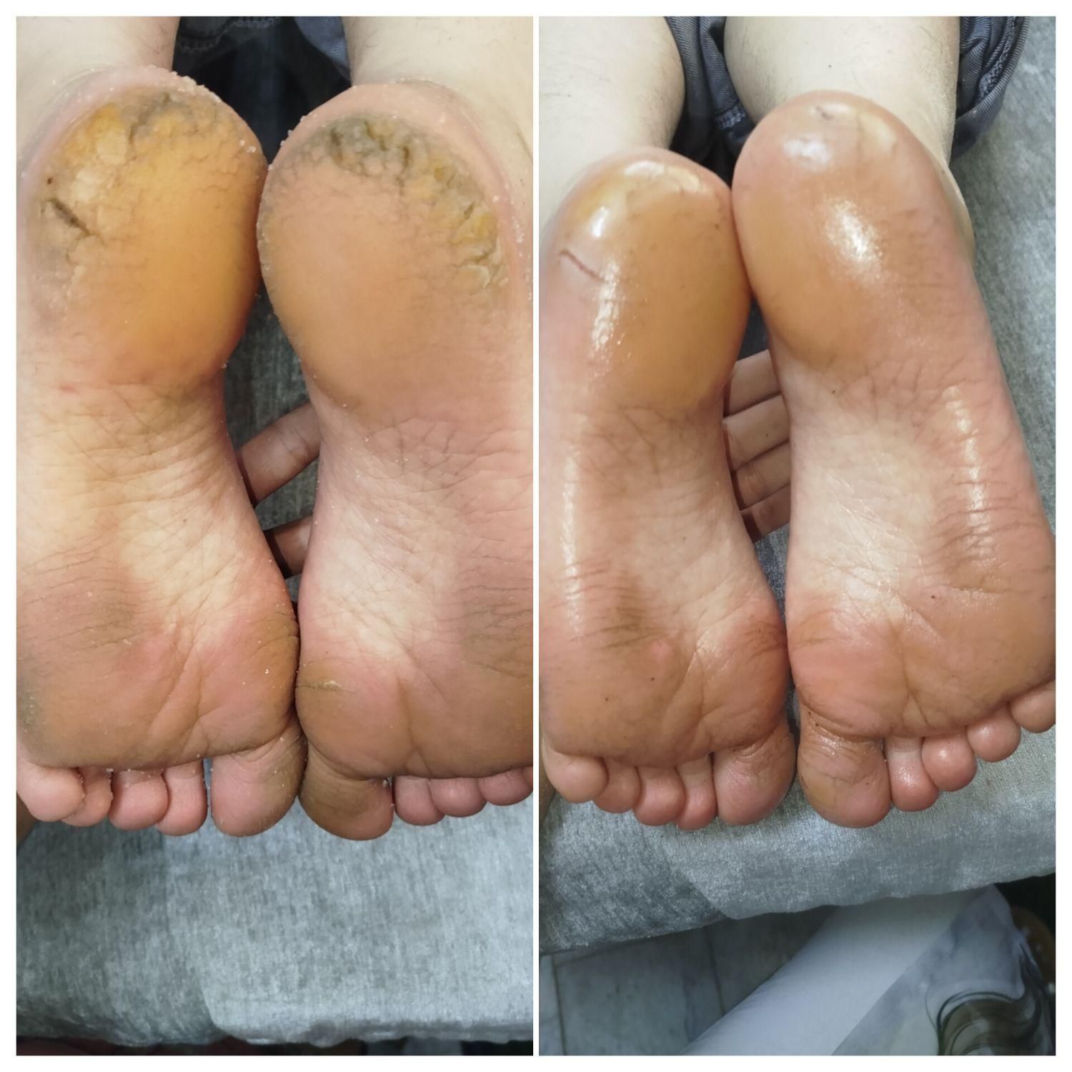 کاشت ناخن،پاکسازی،کاشت مژه،اپلاسیون،کفسابی|خدمات آرایشگری و زیبایی|اصفهان, ملک‌شهر|دیوار