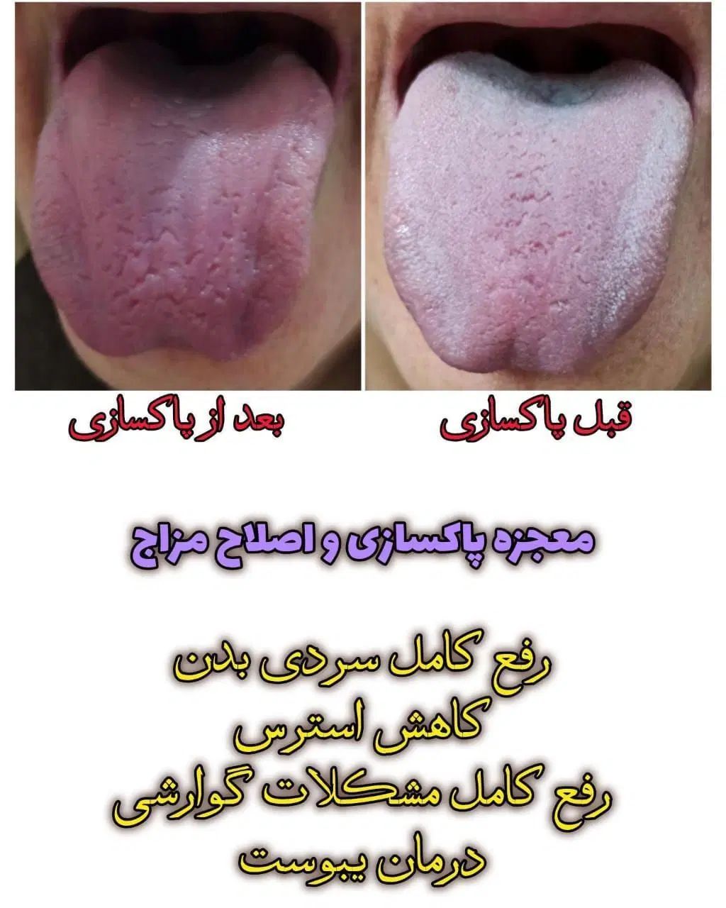 پاکسازی بدن از طریق زبان شناسی|آرایشی، بهداشتی، درمانی|مشهد, شهرک بهارستان|دیوار