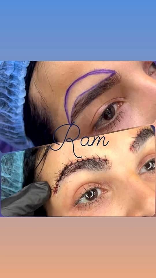 جراحی زیبایی ابرو شقیقه لابیا تنگی بیکینی واریس|خدمات آرایشگری و زیبایی|صدرا-فارس, فاز ۱|دیوار