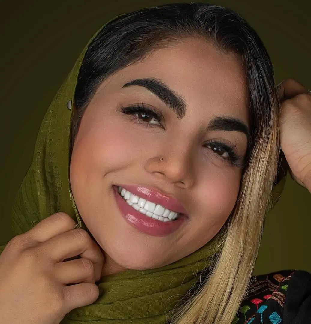 لمینیت/ترمیم دندان/کامپوزیت/پالیش/روکش ایمپلنت|خدمات آرایشگری و زیبایی|تهران, تهران پارس|دیوار