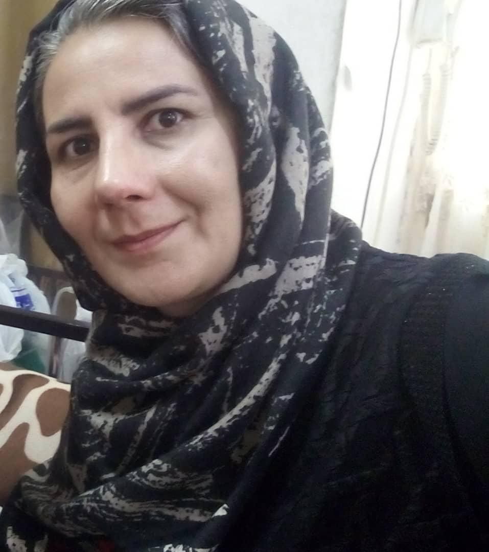 عمل زیبای بینی|خدمات آرایشگری و زیبایی|قائم‌شهر, |دیوار