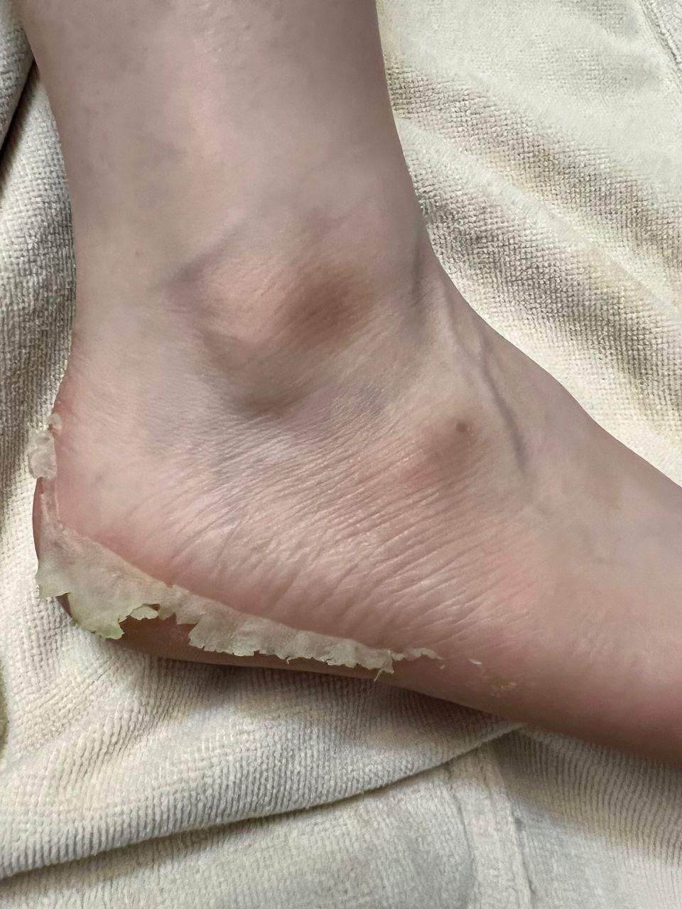 بیماری های ناخن تیرگی قوزک پدیکور آقایان و خانم ها|خدمات آرایشگری و زیبایی|زنجان, |دیوار