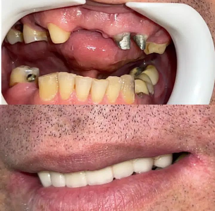 مطب دندانپزشکی در فاضل آباد با شرایط ویژه|خدمات آرایشگری و زیبایی|فاضل آباد, |دیوار