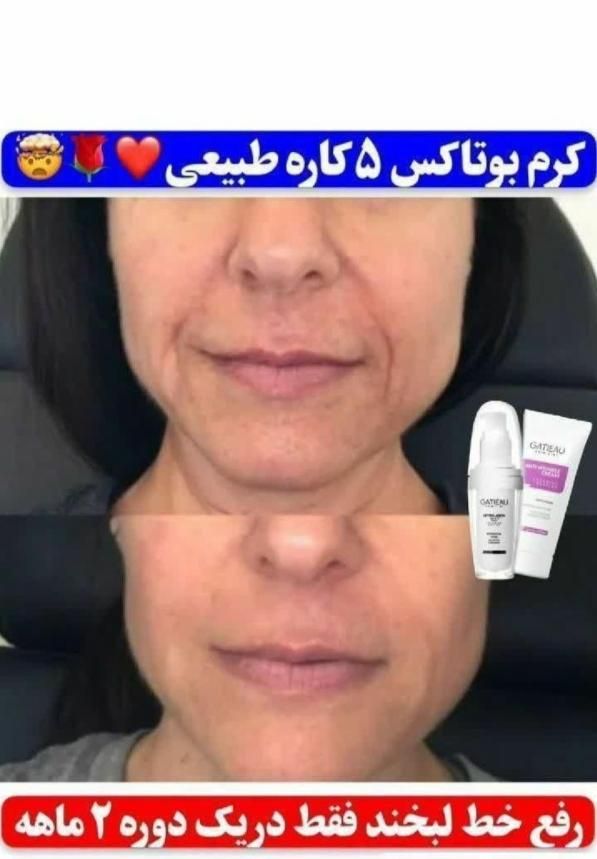 نمایندگی اصلی کرم ضد چین و چروک گاتیو(کرم ۵کاره)|آرایشی، بهداشتی، درمانی|تهران, جنت‌آباد جنوبی|دیوار
