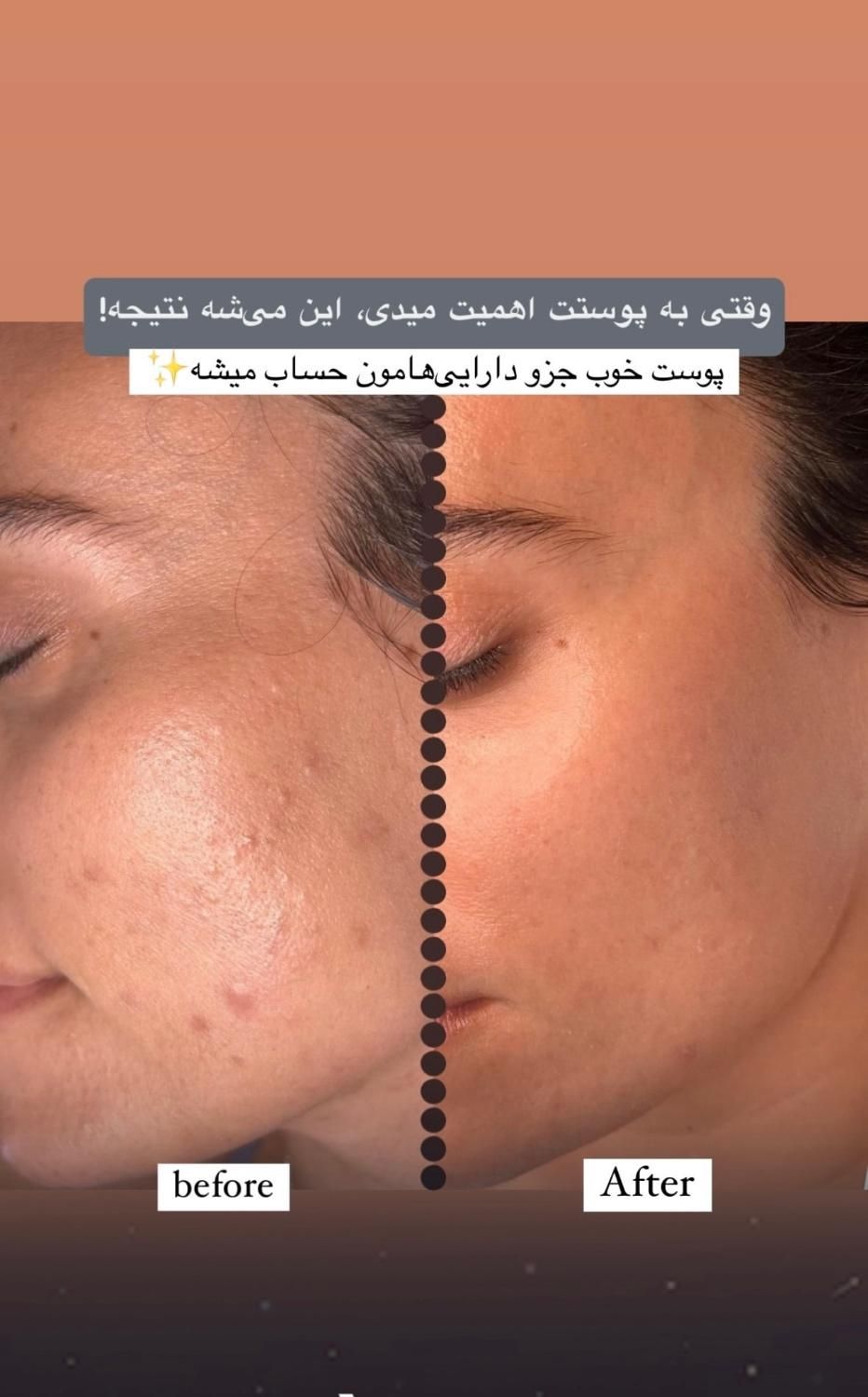پاکسازی پوست به صورت تخصصی(بانوان)|خدمات آرایشگری و زیبایی|مشهد, آبکوه|دیوار