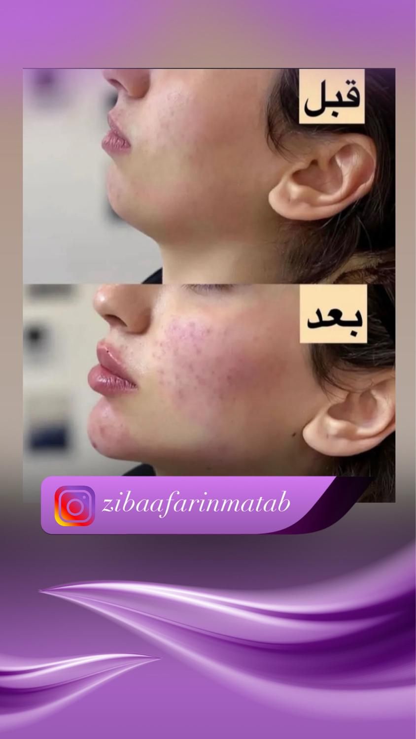 کلینیک زیبای و جراحی|خدمات آرایشگری و زیبایی|بندر گناوه, |دیوار