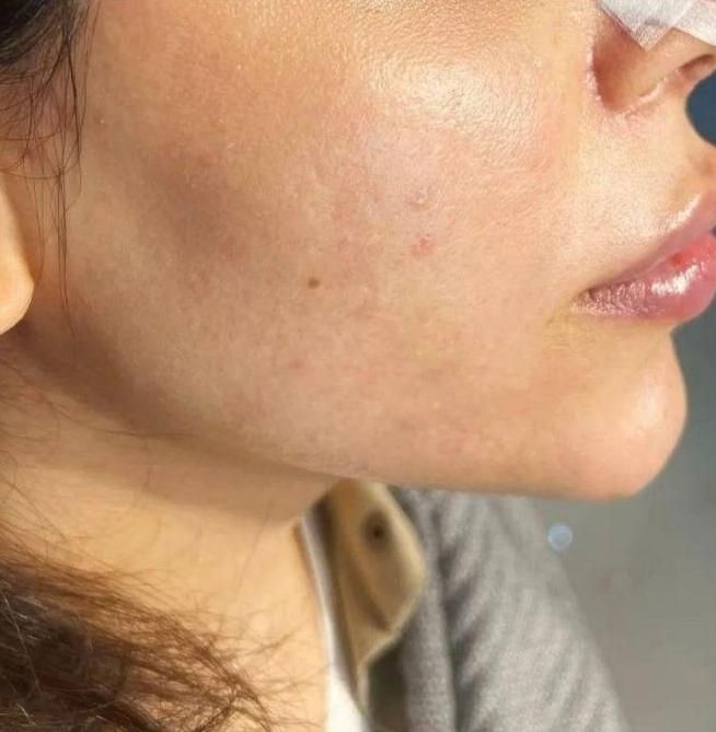 ژل لب فیلربینی مزو بوتاکس ژل بدن  ۳۹۹ آموزش پزشک|خدمات آرایشگری و زیبایی|فردیس, |دیوار