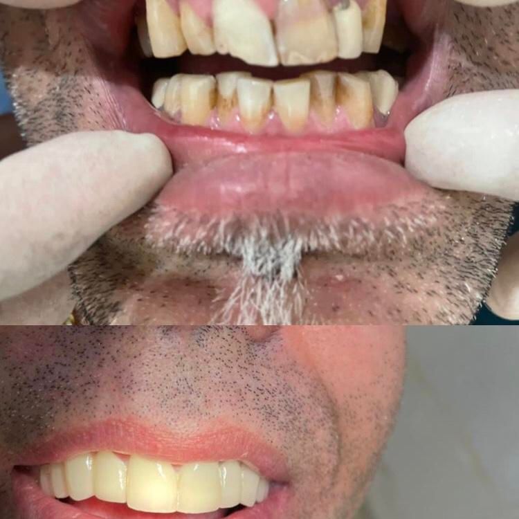 خدمات دندانپزشکی و دندانسازی مستر دِنت|خدمات آرایشگری و زیبایی|ارومیه, |دیوار