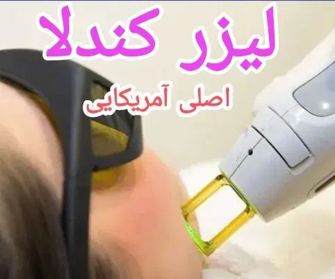 لیزر موهای زائد کندلا اصلی آمریکایی در مطب|خدمات آرایشگری و زیبایی|ایلام, |دیوار
