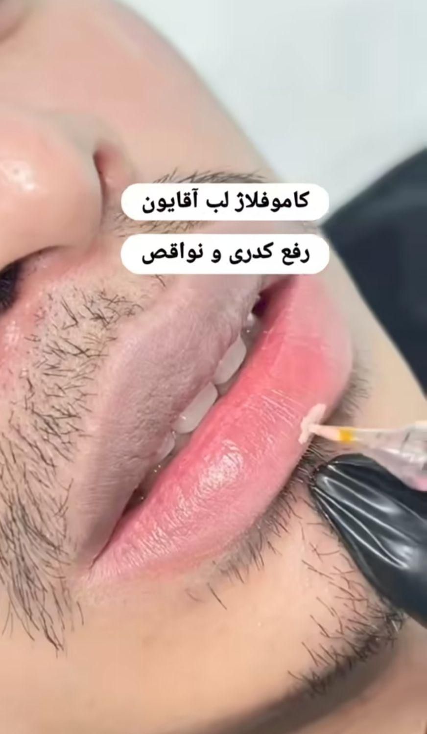 رفع تیرگی لب ،شیدینگ لب ،اسکالپ موی سر آقایون|خدمات آرایشگری و زیبایی|زاهدان, |دیوار