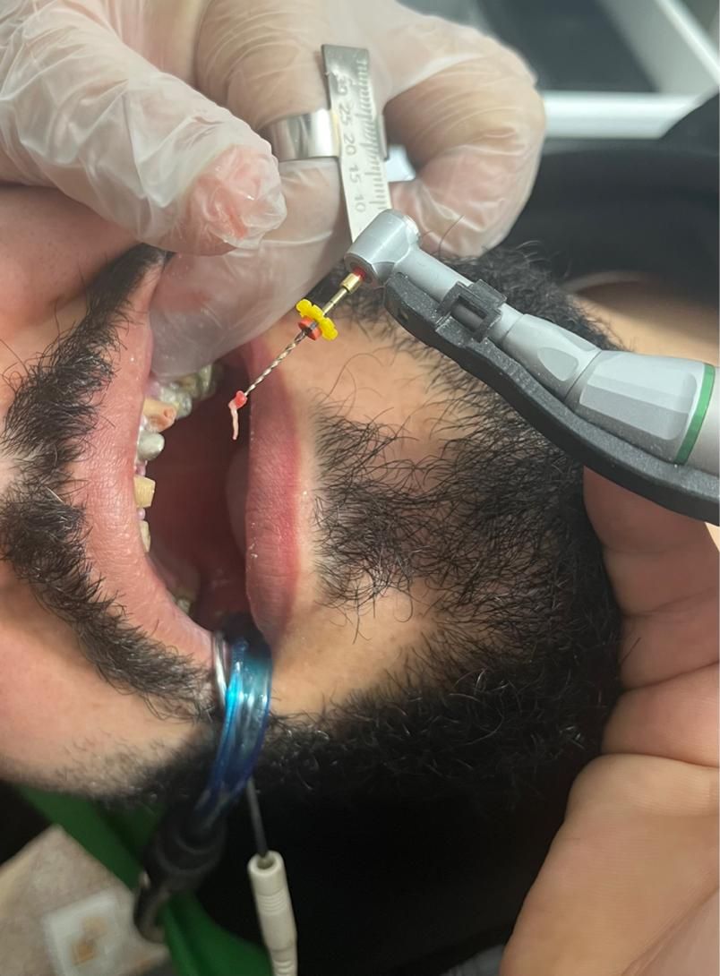 دندان سازی|خدمات آرایشگری و زیبایی|خوی, |دیوار