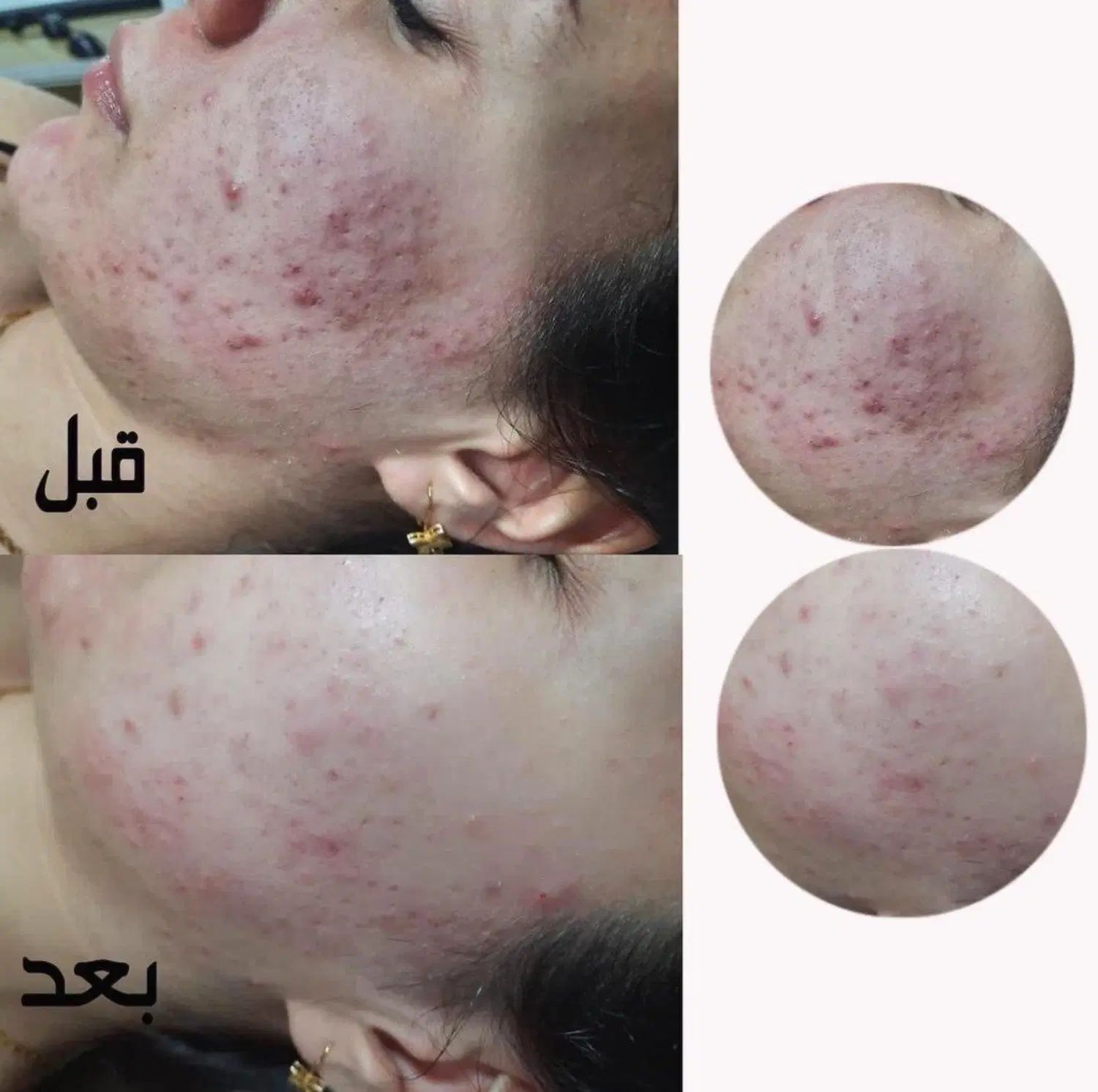 کربوکسی تراپی+فیشال تخصصی ۴۷۵ ظرفیت ۵ نفر|خدمات آرایشگری و زیبایی|بیرجند, |دیوار