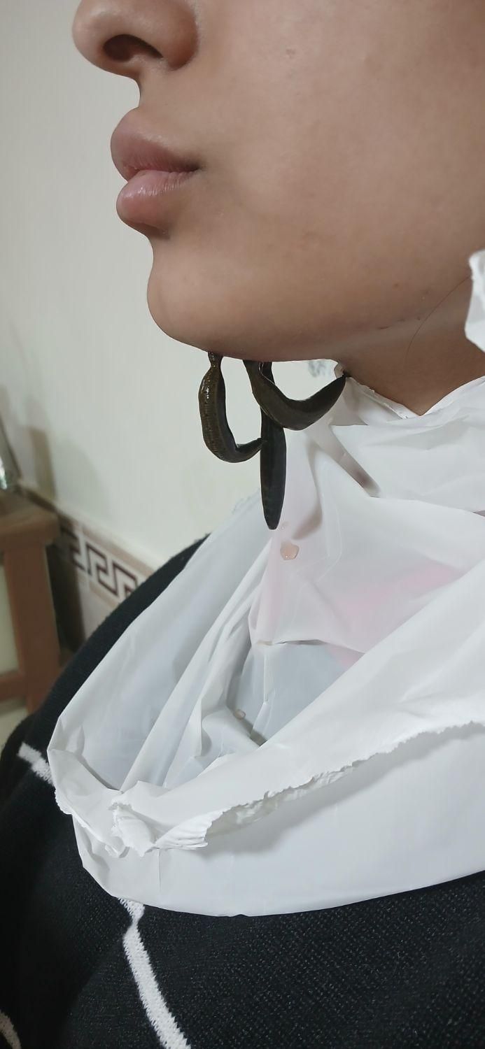 حجامت،زالو‌درمانی، فصدخون،طب سوزنی،مزاج شناسی|خدمات آرایشگری و زیبایی|تهران, بیسیم|دیوار