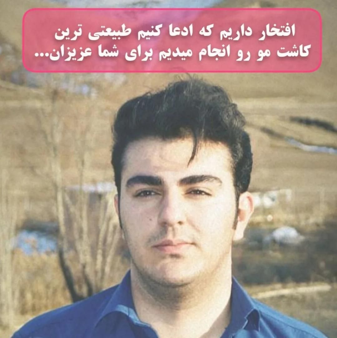 کاشت مو|خدمات آرایشگری و زیبایی|شیراز, زرگری|دیوار