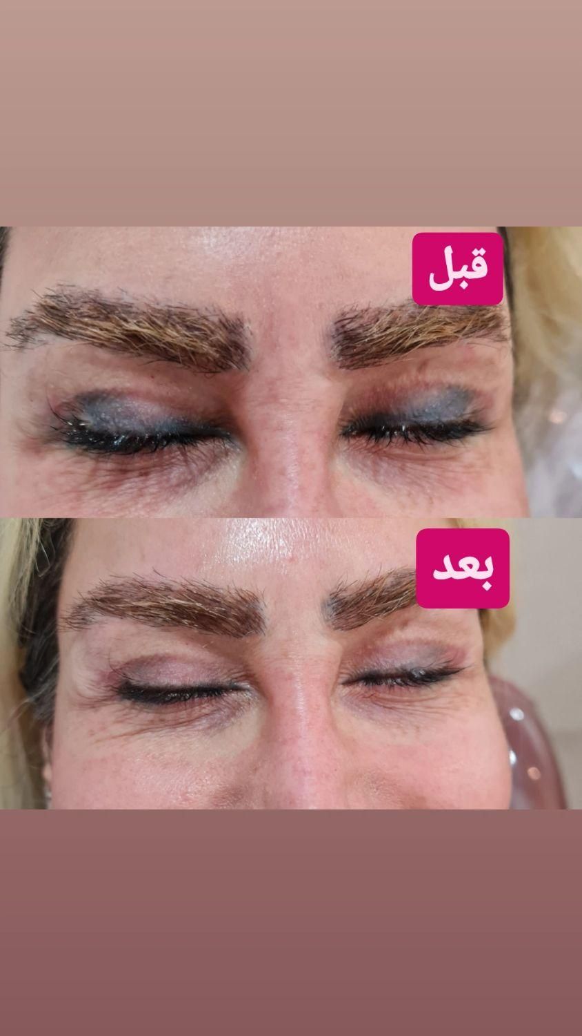 کلینیک لیزرتتو ابرو،خط چشم،خط لب،ریموو،ریمو|خدمات آرایشگری و زیبایی|شیراز, فرهنگ شهر|دیوار